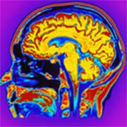 CT scan of a human head