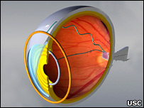 Eyechip (USC)