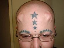Star implants by Steve Haworth have completely healed over. 