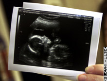 story.ultrasound.hand.gi.jpg