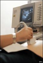 An ultrasound is carried out