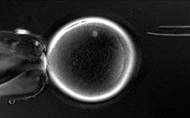 The skin cell inserted into a primate egg (shown) came from a monkey called Semos - also the name of the god in the popular sci-fi work Planet of the Apes.